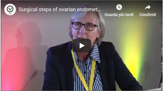 Prof. M.Nisolle – Surgical steps of ovarian endometriomas